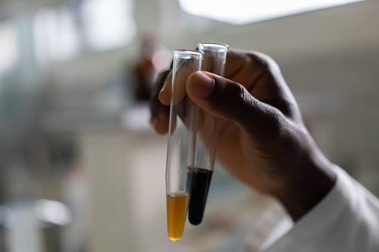 Traditional Medicine Meets Modern Science: Ghana's Herbal Research Breakthrough